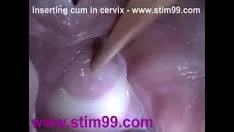 Introduce in vaginul ei foarte larg o bucata de plasti extrem de mare